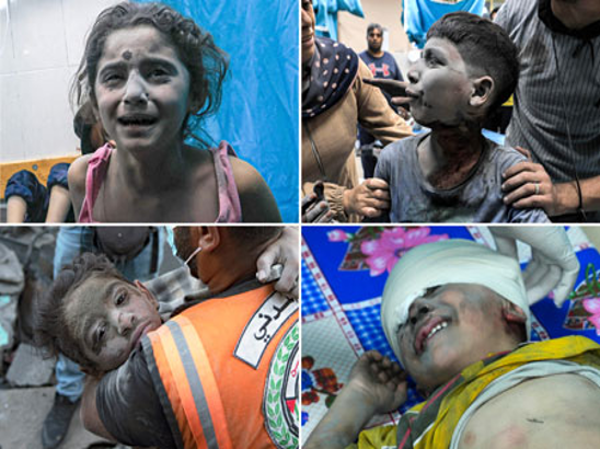 Un collage de fotografías de niños con heridas.